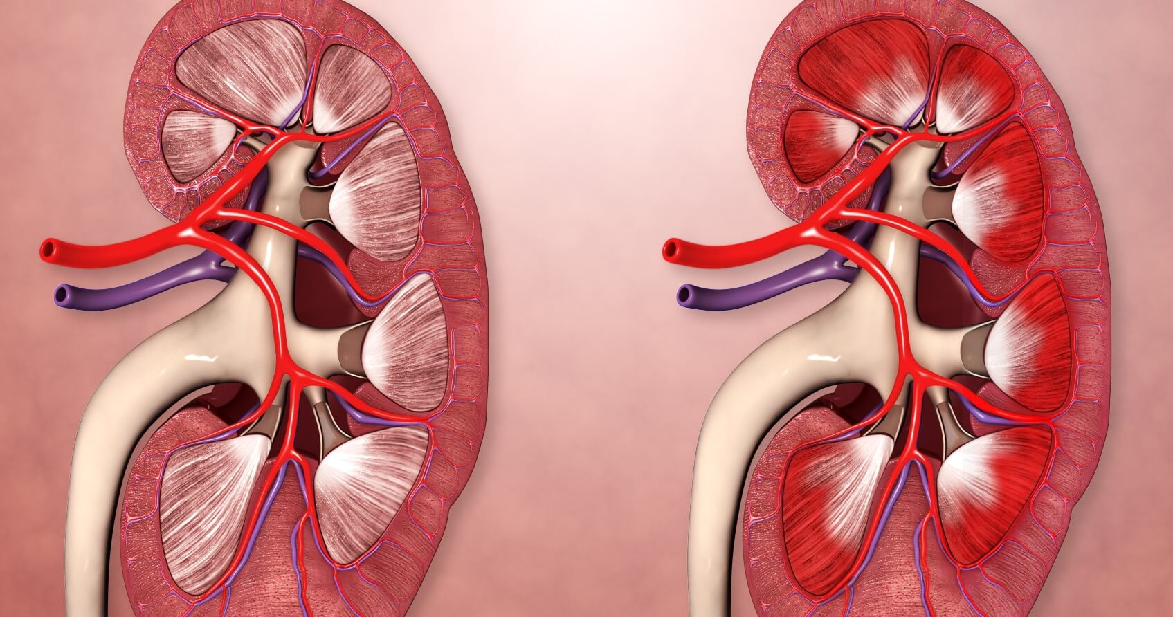 Akut Poststreptokokkal Glomerulonefrit