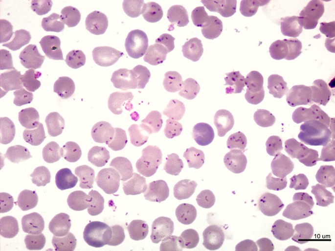 Bartonella (Carrion Hastalığı)